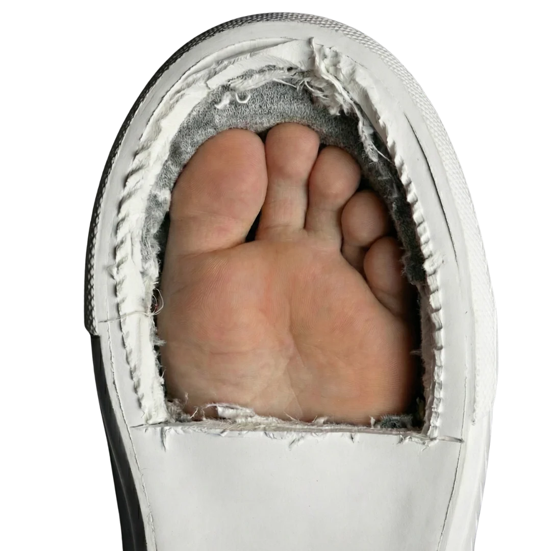Other shoe narrow toe box cut open